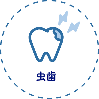 虫歯