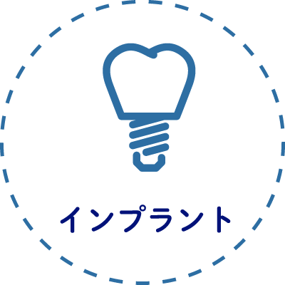 インプラント